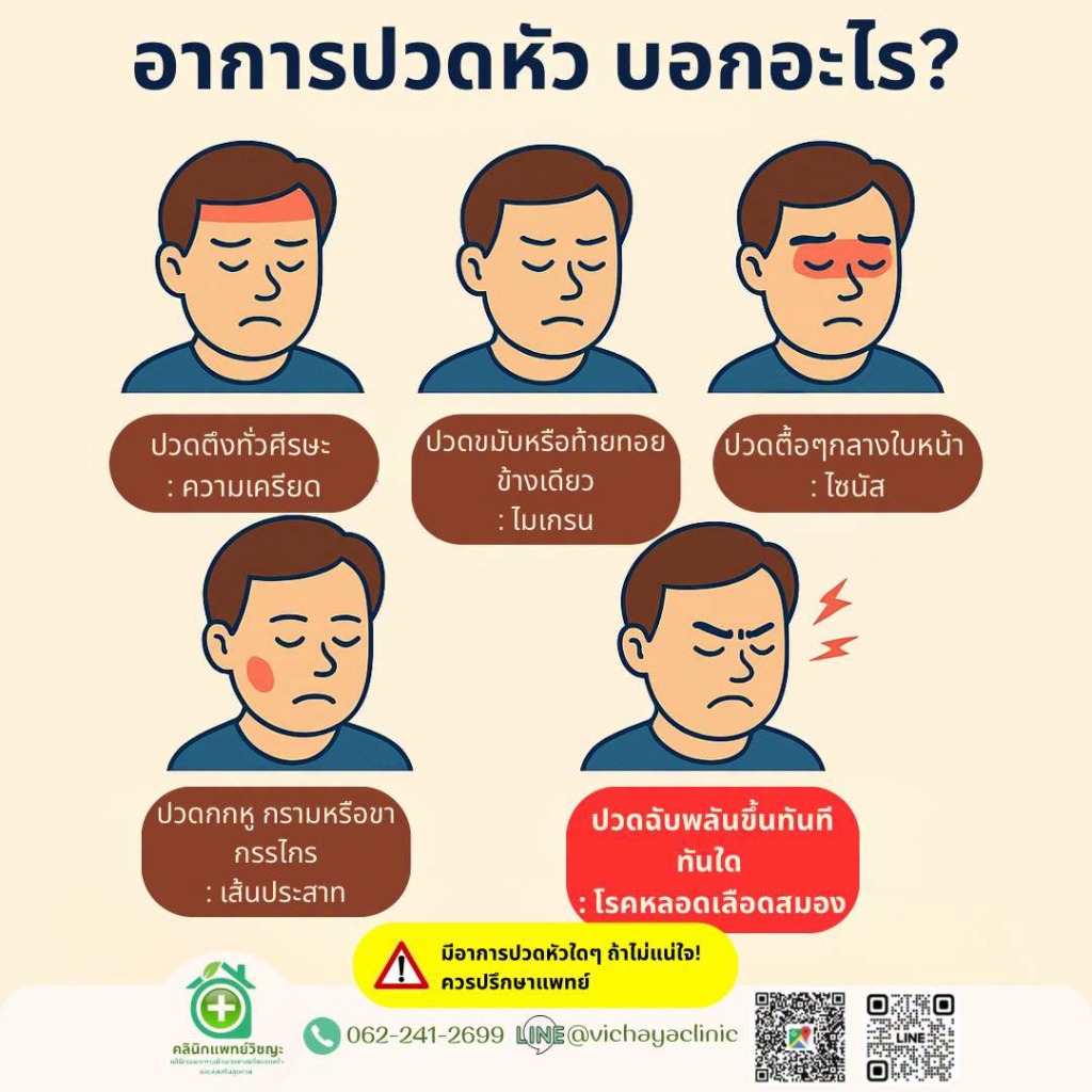 อาการปวดหัว บอกอะไร? อินโฟกราฟิกเปรียบเทียบอาการปวดหัว 5 รูปแบบ ได้แก่ ปวดตึงทั่วศีรษะจากความเครียด ปวดขมับหรือท้ายทอยข้างเดียวไมเกรน ปวดตื้อๆ กลางใบหน้าไซนัส ปวดกกหูกรามหรือขากรรไกรเส้นประสาท และปวดฉับพลันขึ้นทันทีทันใดโรคหลอดเลือดสมอง โดยคลินิกแพทย์วิชญะ หาดใหญ่ สงขลา โทร 062-241-2699